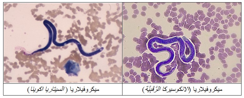 مرض الفلاريا في الفصيلة الخيلية