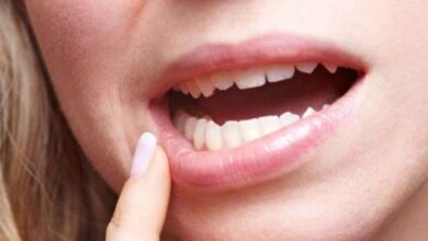 تفسير حلم وقوع الأسنان الأمامية