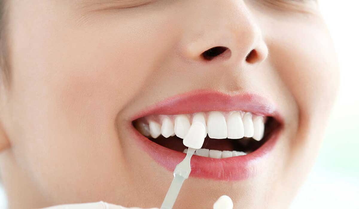 تفسير حلم وقوع الأسنان لابن سيرين