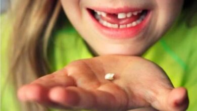 حلم سقوط الأسنان